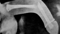 Forr�s: [origo]